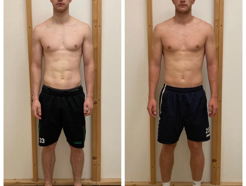 Yannick before-after vooraanzicht